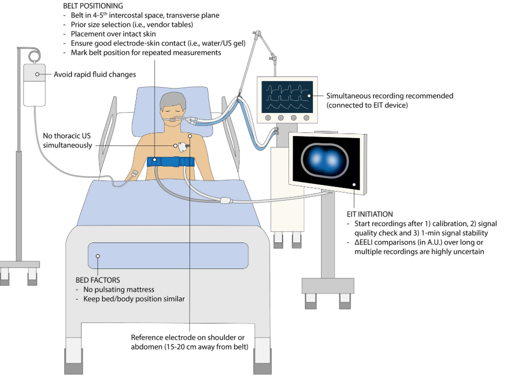 EIT setup for lung monitoring using Sciospec’s EIT device in ventilated patients.